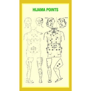 HE Kit 6pcs 2
